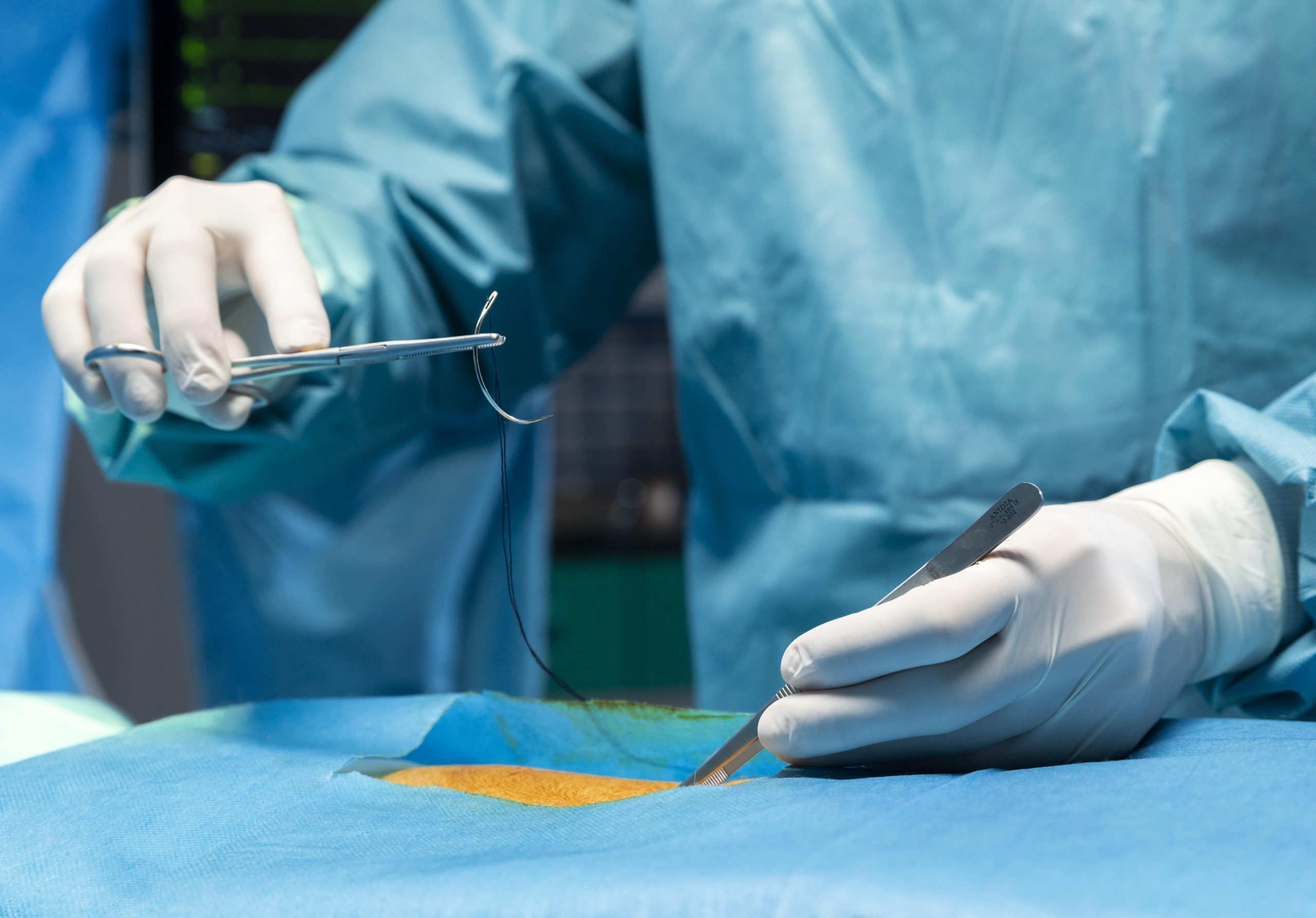 सर्जरी / SURGERY