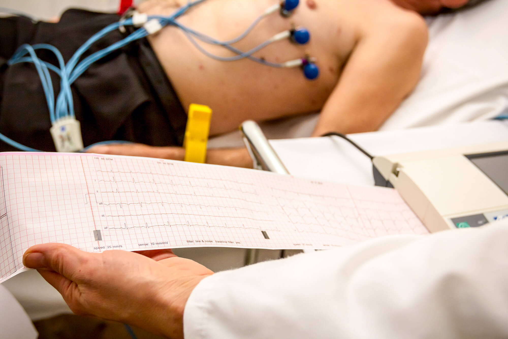 ई.सी.जी/ ECG FACILITY
