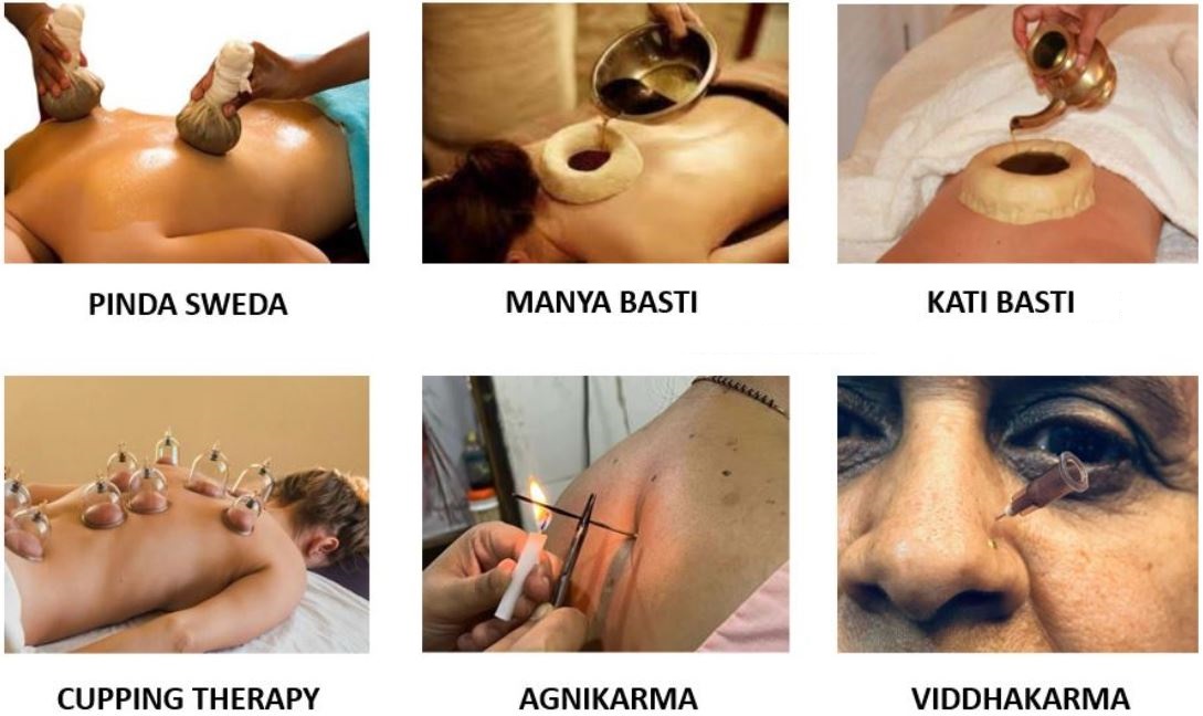 PANCHAKARMA SERVICES