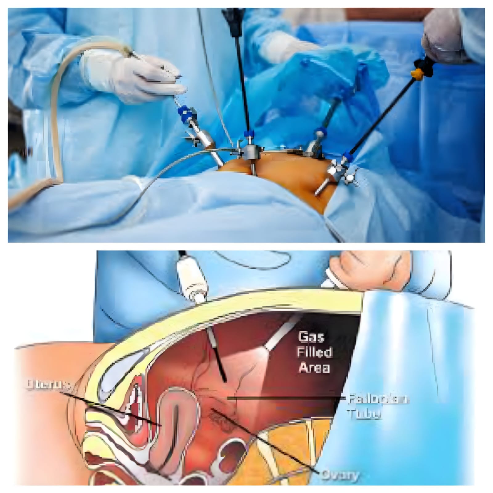 LAPAROSCOPIC & GYNAECOLOGICAL SURGERIES
