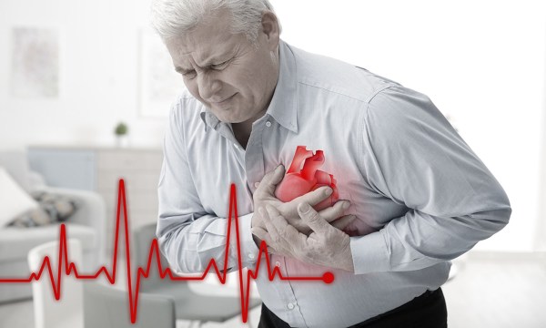 हृदयविकाराचा झटका येणे – Heart Attack