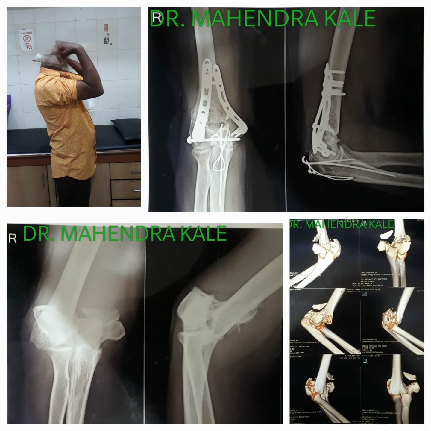 SHRI AUROBINDO HOSPITAL AND ACCIDENT REHABILITATION ACADEMY