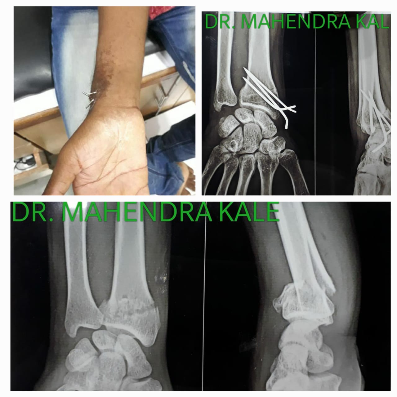 SHRI AUROBINDO HOSPITAL AND ACCIDENT REHABILITATION ACADEMY