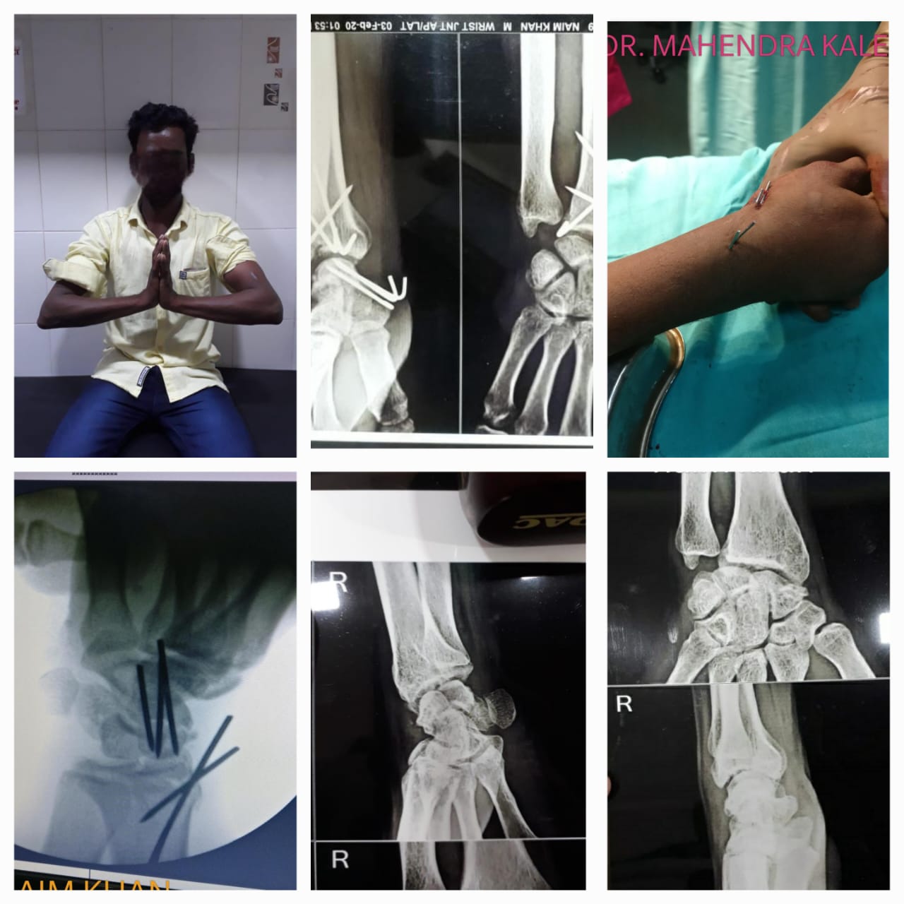 SHRI AUROBINDO HOSPITAL AND ACCIDENT REHABILITATION ACADEMY