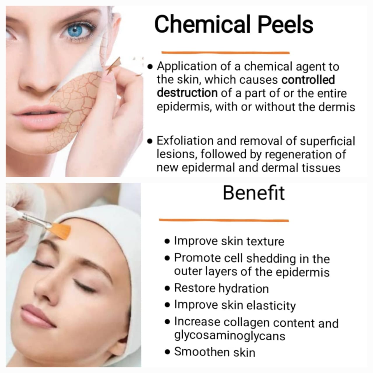 CHEMICAL PEELS