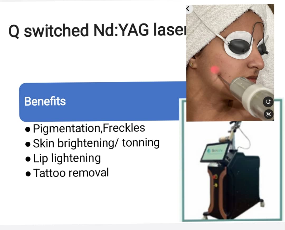 Q SWITCHED ND : YAG LASER
