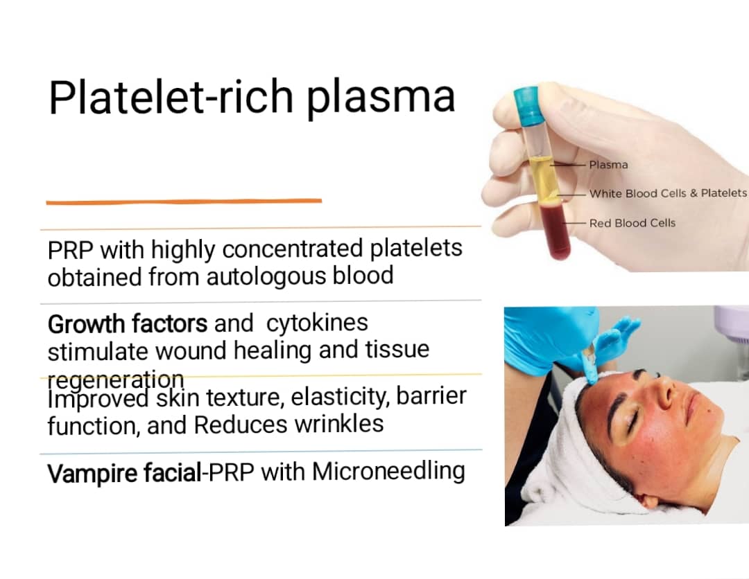 PLATELET RICH PLASMA