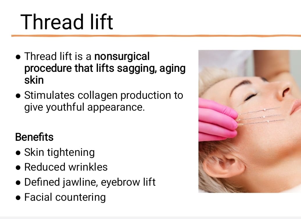 THREADLIFT