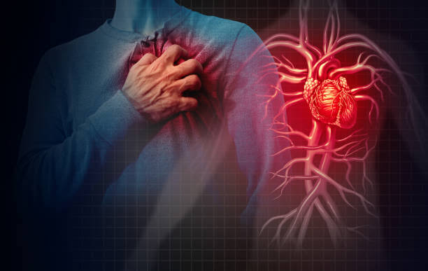 हृदयविकाराचा झटका येणे – Heart Attack