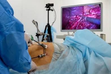 GENERAL & LAPAROSCOPIC SURGERY