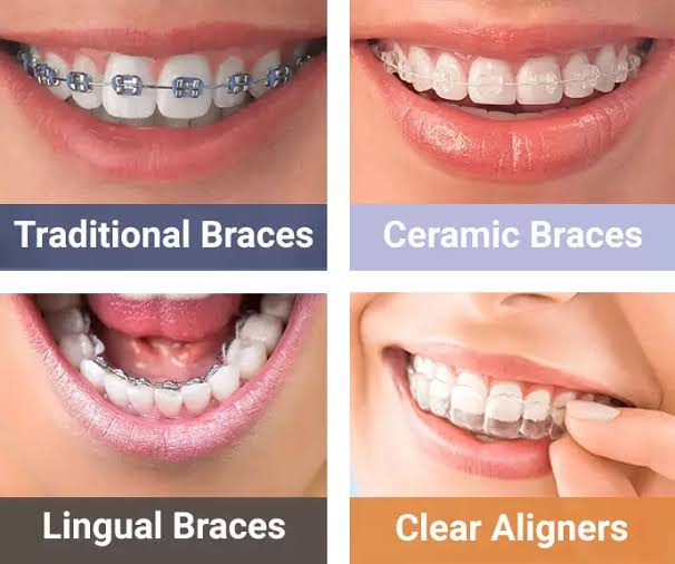 ORTHODONTIC TREATMENT