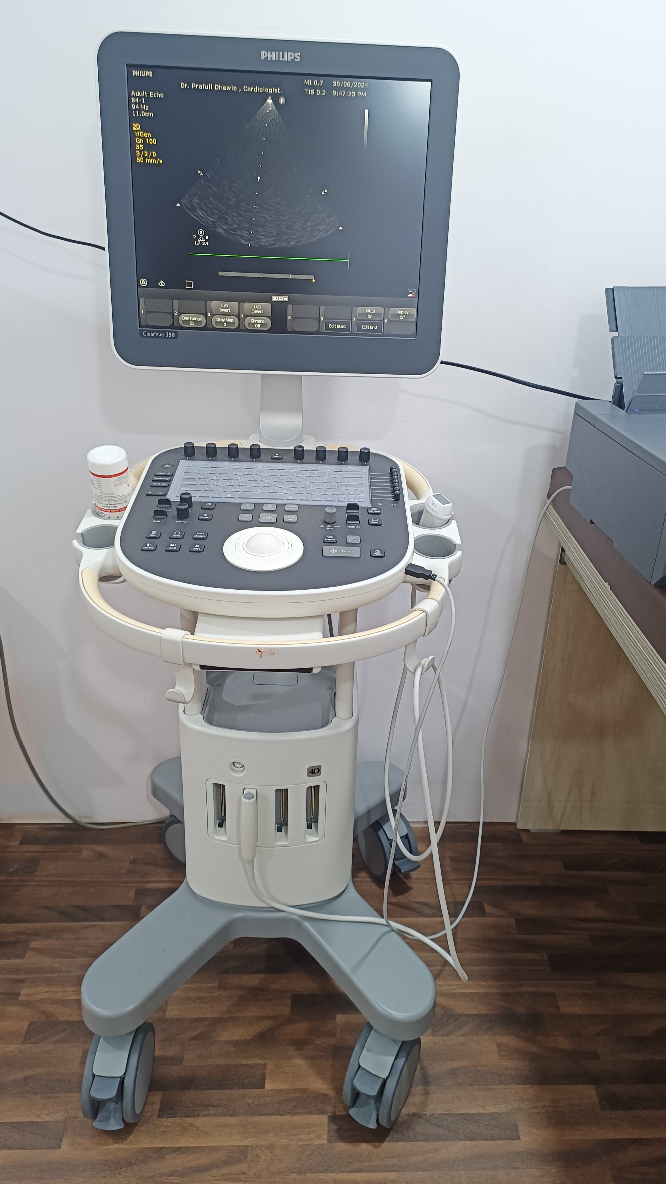 ECHOCARDIOGRAM (2D ECHO)