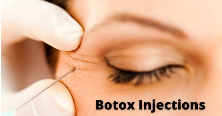 BOTOX INJECTION