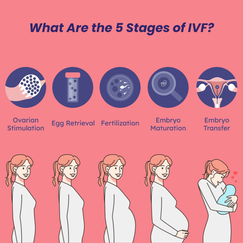 IVF