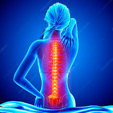 BACK  PAIN
