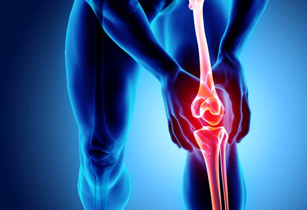 KNEE PAIN