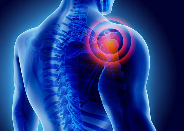 SHOULDER PAIN