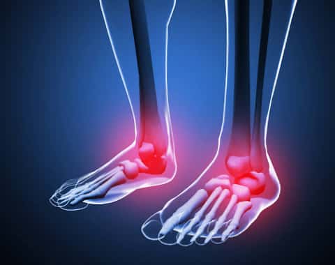 FOOT PAIN