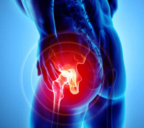 THE HIP PAIN