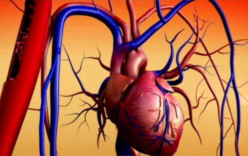 हृदयविकाराचा झटका येणे – Heart Attack
