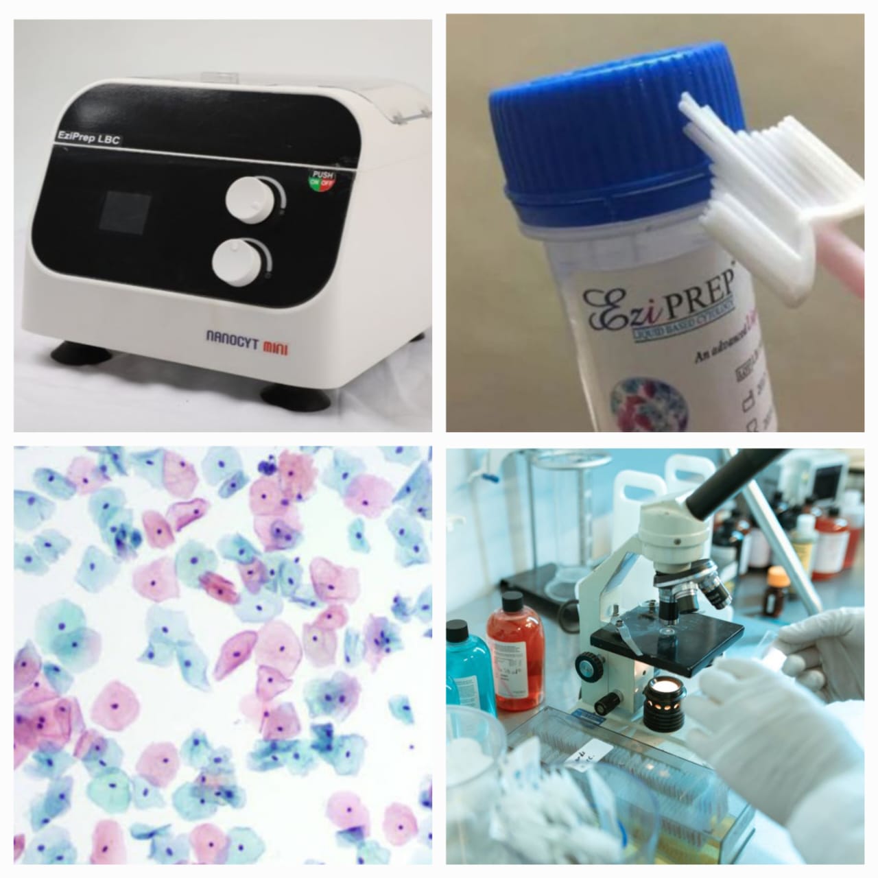 पॅप स्मीयर तपासणी आणि L.B.C. (Liquid based cytology)