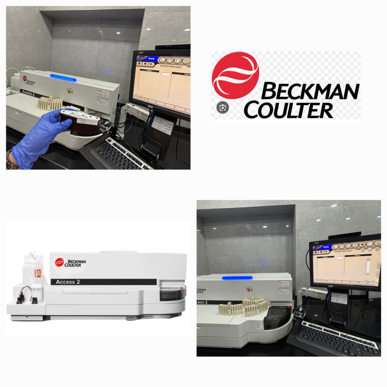 Fertility markers/Thyroid Test/Vit. B12/ Vit.D/ PSA etc. by Beckman Coulter instrument.