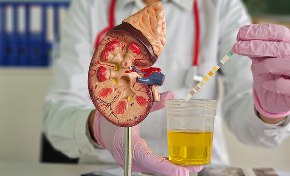 RENAL FUNCTION TEST (RFT)