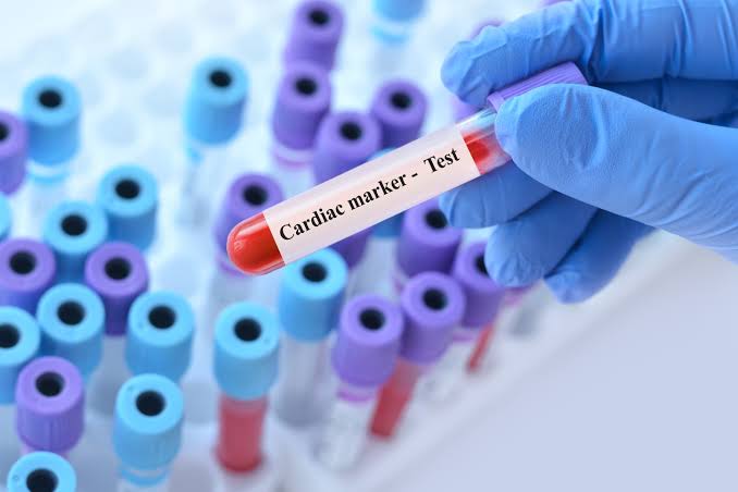 CARDIAC MARKER TEST