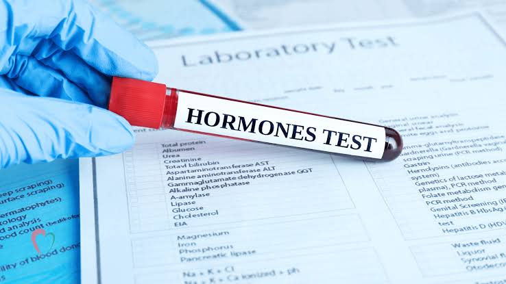 Hormonal Assays Test