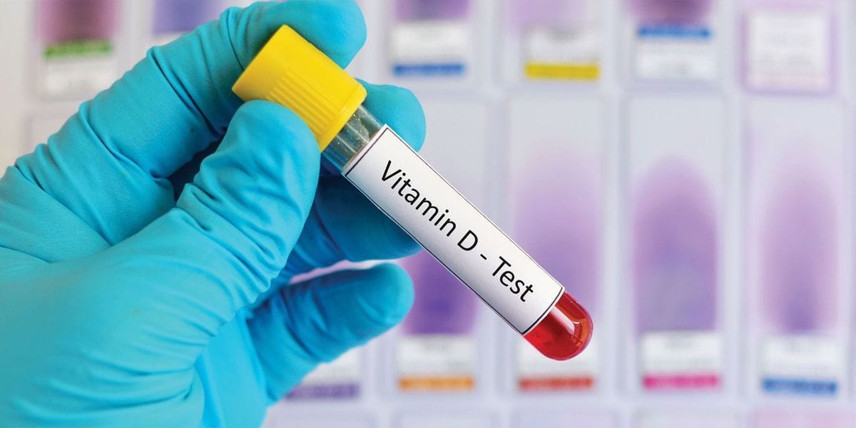 VITAMIN ASSAYS TEST