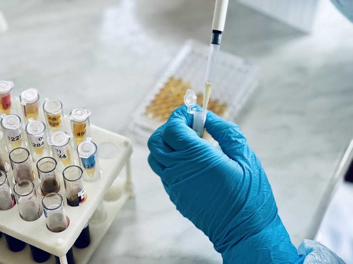 SEROLOGY TESTS