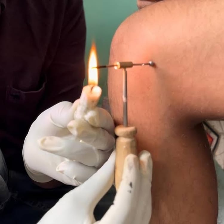 AGNIKARMA AND VIDHAKARMA