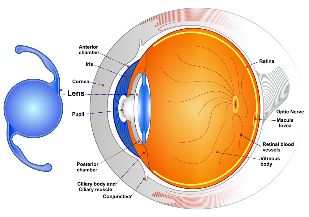 IMPORTED AND INDIAN INTRACULAR LENSES