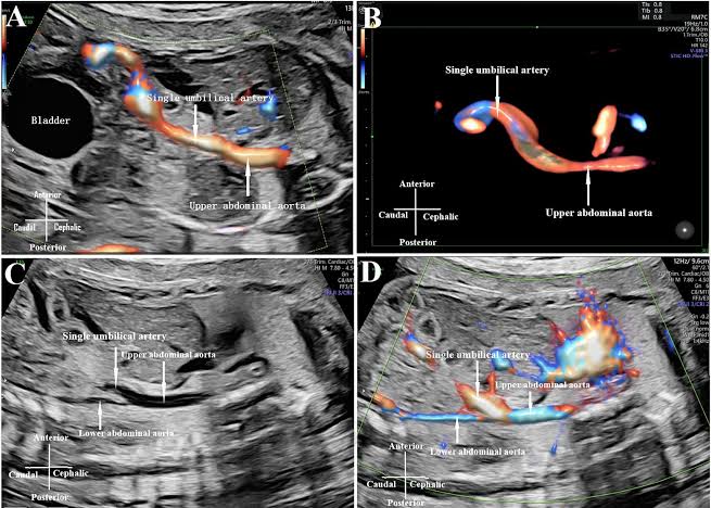 ADVANCED HIGH RESOLUTION ULTRASOUND