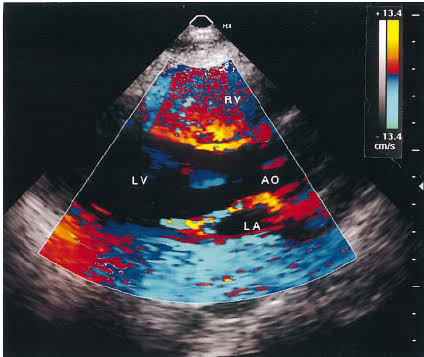 COLOUR DOPPLER