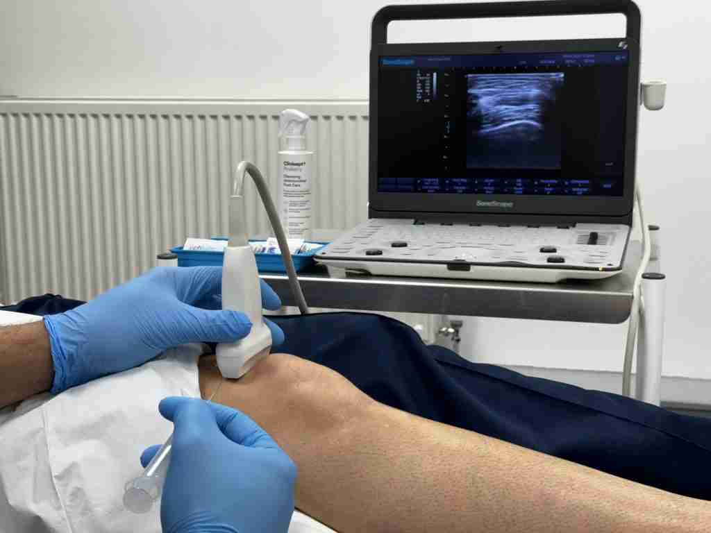 ULTRASOUND GUIDED PROCEDURE