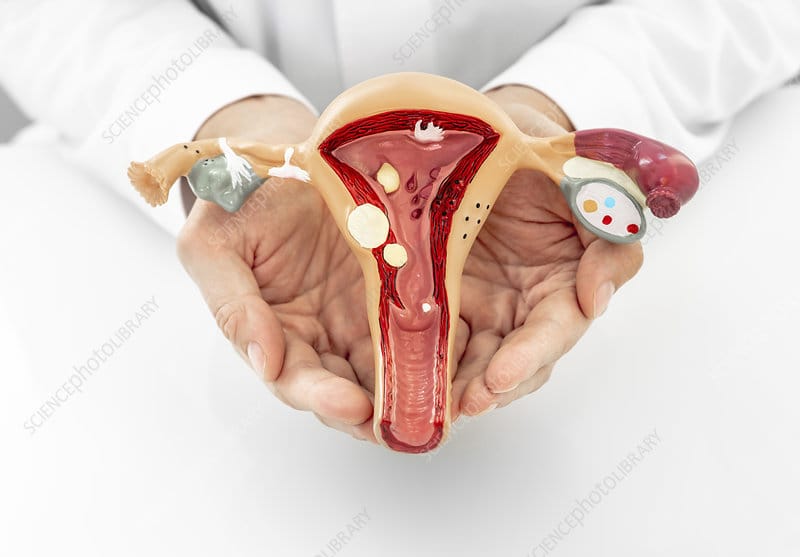 GYNAECOLOGICAL DISORDERS