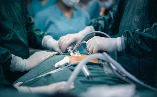 LAPAROSCOPY