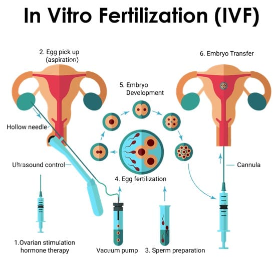 INFERTILITY