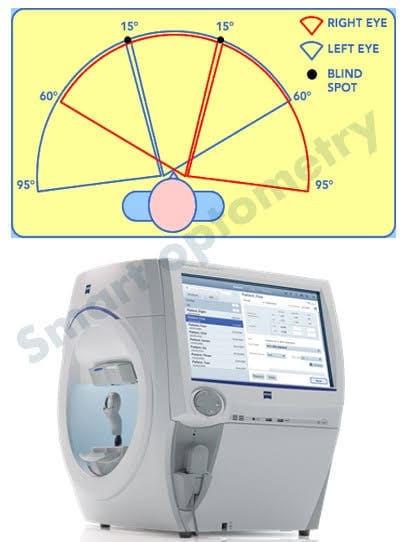 ॲटोमेटेड फिल्ड ॲनालिसीस (Perimetry)