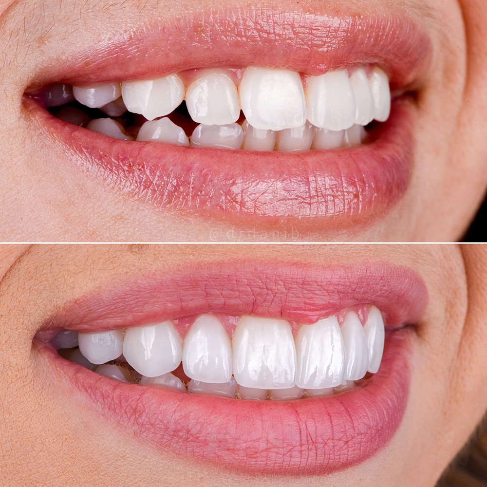 COSMETIC DENTISTRY