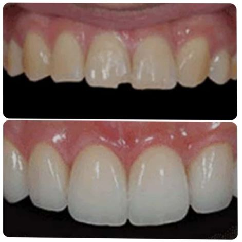 COSMETIC DENTISTRY