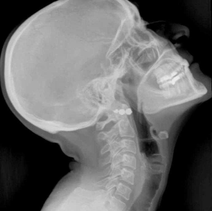 डिजिटल रेडिओग्राफी