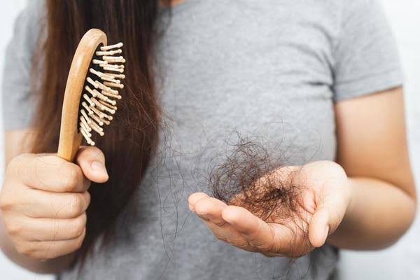 Alopecia - केस गळती