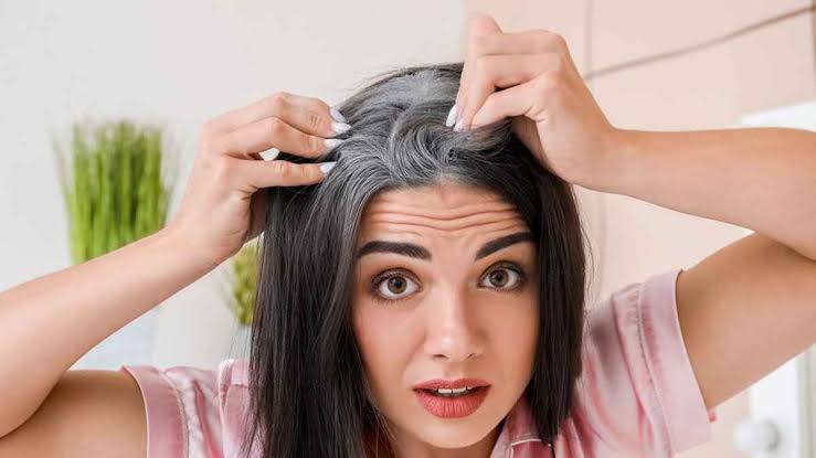 Premature Greying Of Hair - केस पांढरे होने