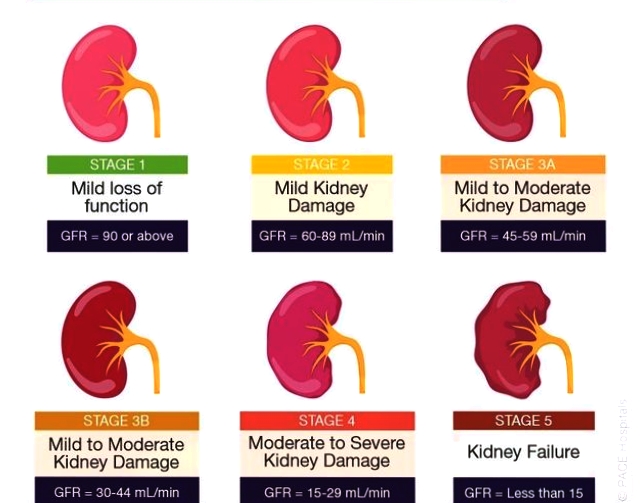 Chronic disease management like Diabetes, Hypertension, CKD