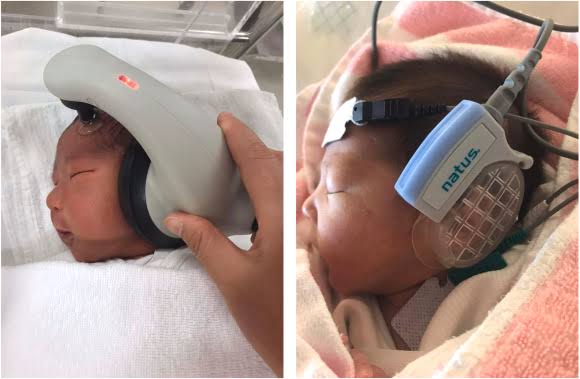 नवजात बाळांमध्ये श्रवण क्षमता तपासणे