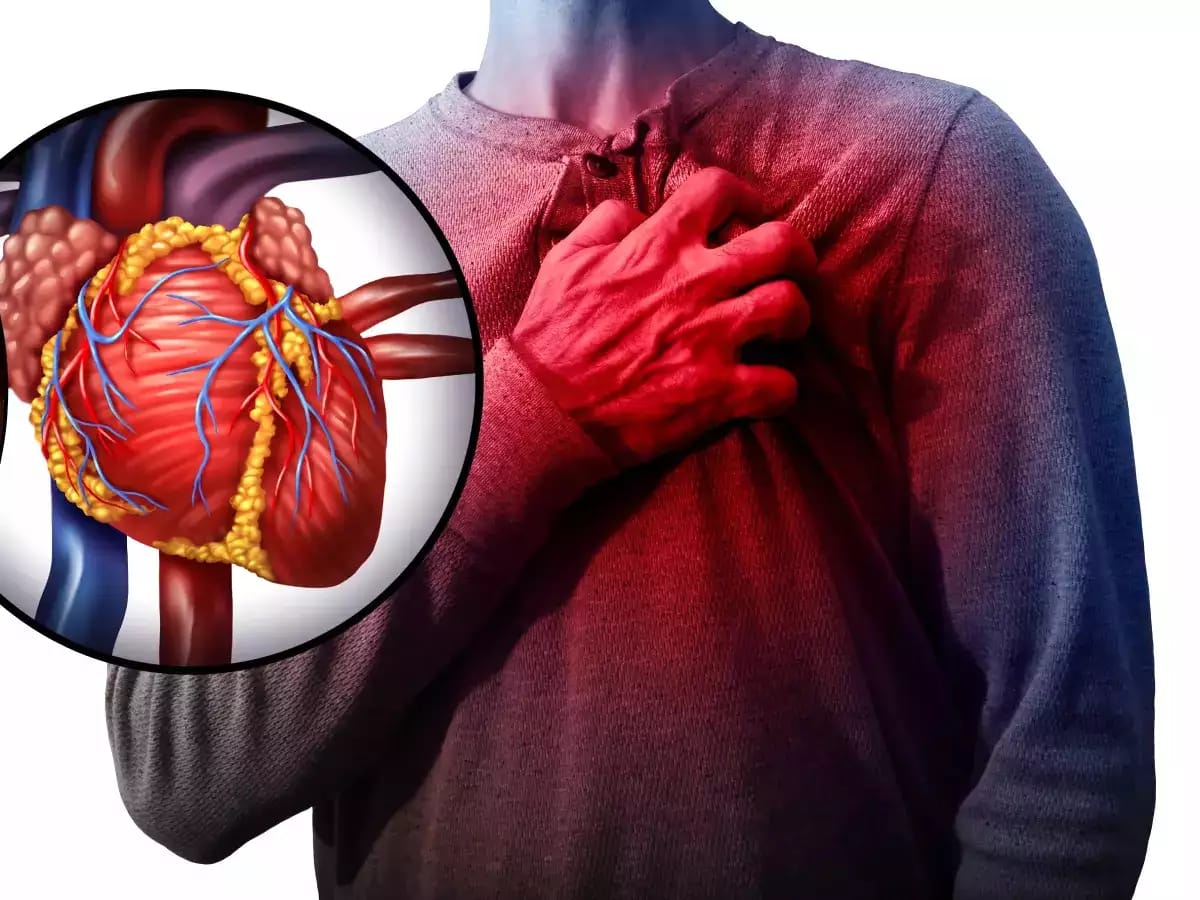 हृदयविकाराचा झटका येणे – Heart Attack