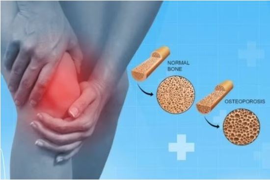 ऑस्टियोपोरोसिस