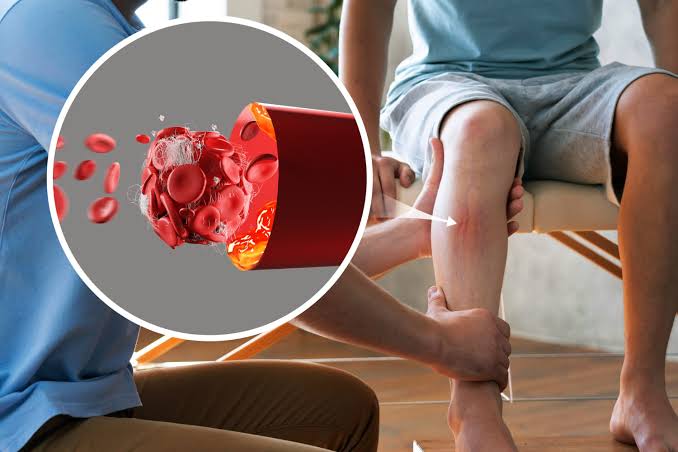 मधुमेही पायावर उपचार (Diabetic Foot Care)